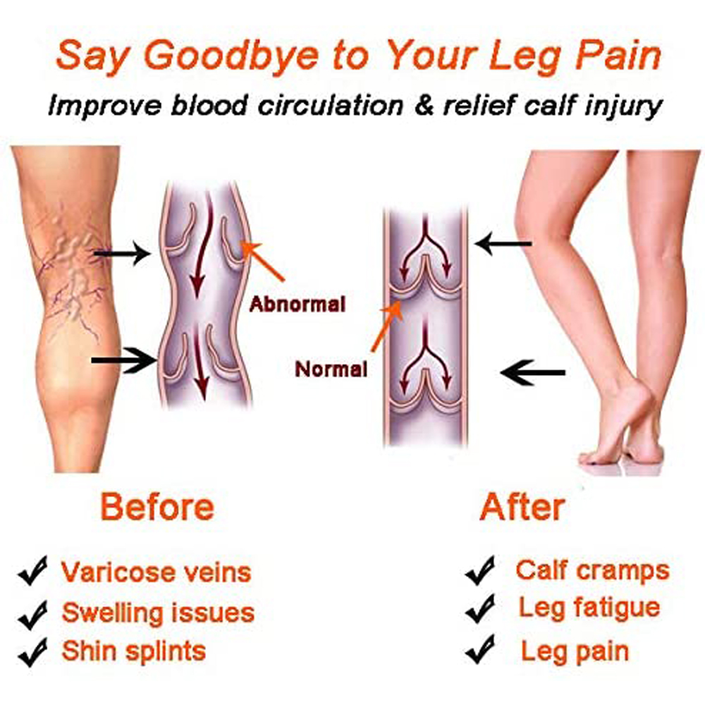 1Pair Calf Compression Sleeve  - đánh giá và giá Compression Sleeve Calf