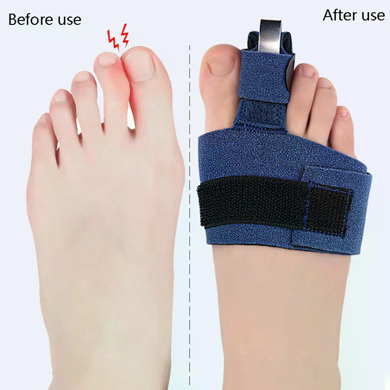1Pcs Toe Corrector Toe Fractur - đánh giá và giá Ankle Brace Sock